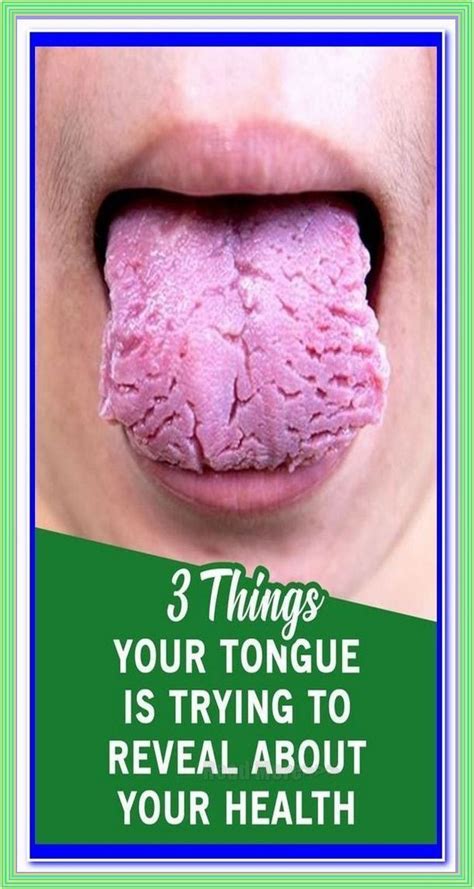 What Your Tongue Says About Your Health